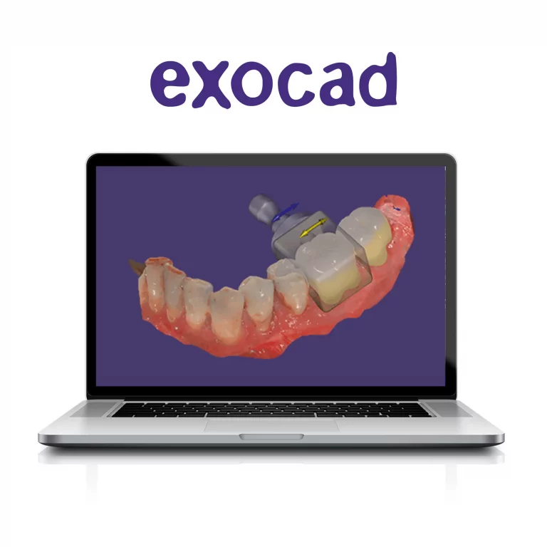 Exocad ChairsideCAD