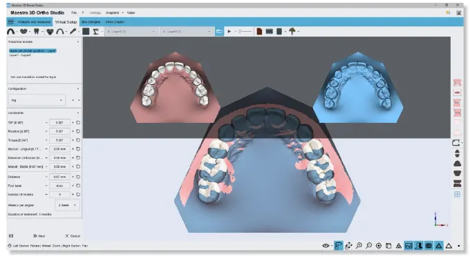 maestro3d dental software